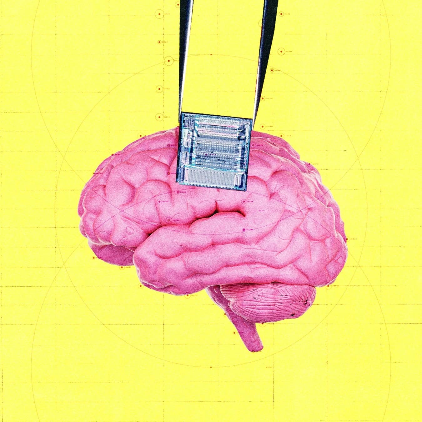 Ilustração de um implante cerebral relacionado à detecção de câncer