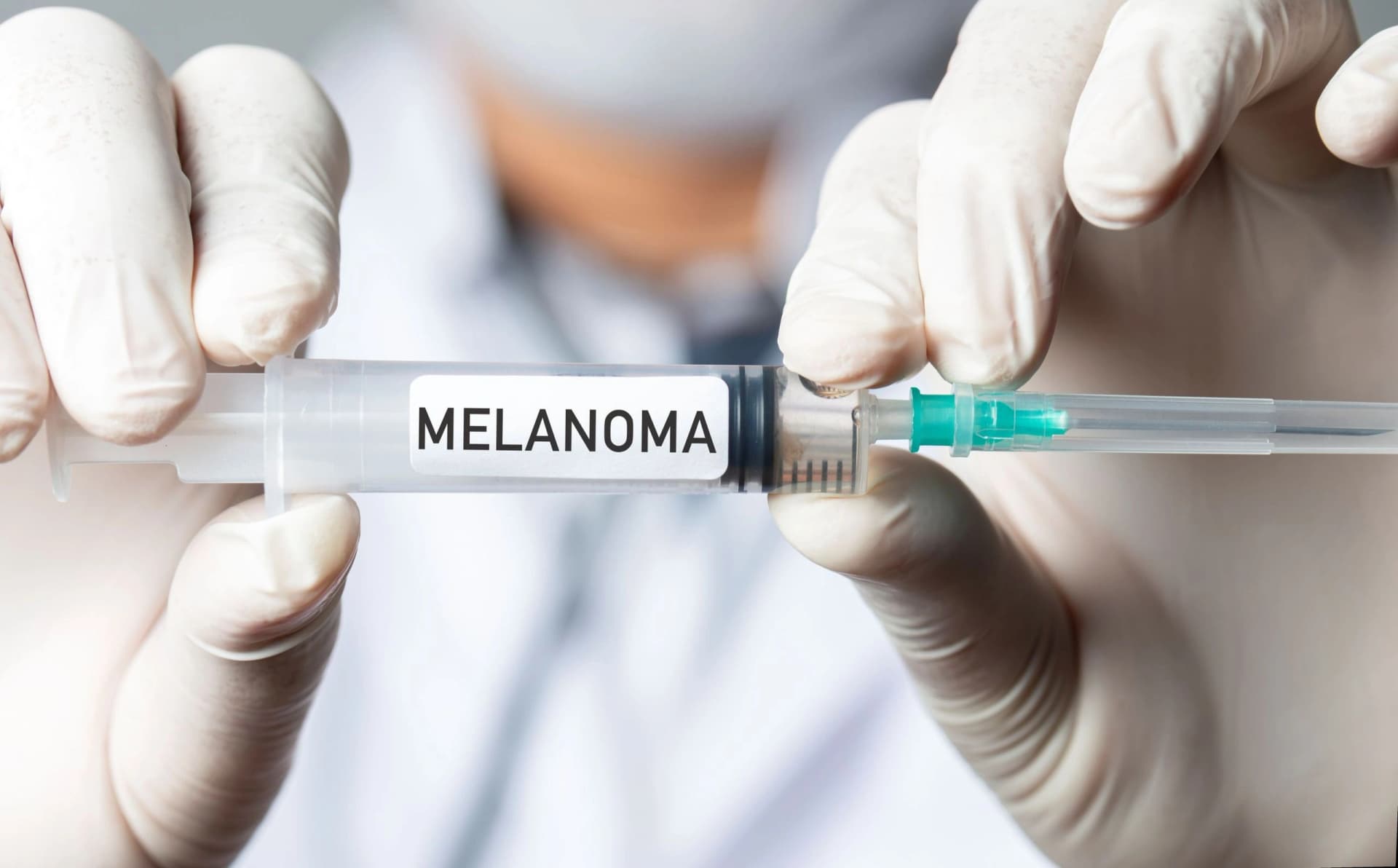 Duas mãos usando luvas brancas seguram uma seringa identificada como melanoma.